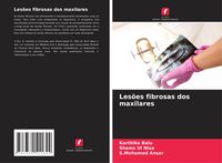 Produktbild: Les&otilde;es fibrosas dos maxilares