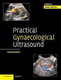 Produktbild: Practical Gynaecological Ultrasound