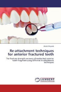 Produktbild: Mujeeb, A: Re-attachment techniques for anterior fractured t
