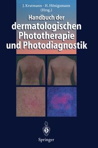 Produktbild: Handbuch der dermatologischen Phototherapie und Photodiagnostik