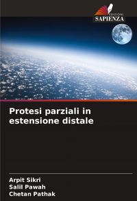 Produktbild: Protesi parziali in estensione distale