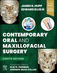 Produktbild: Contemporary Oral and Maxillofacial Surgery