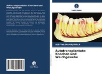 Produktbild: Autotransplantate: Knochen und Weichgewebe