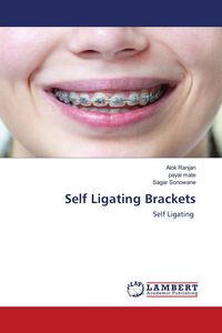Produktbild: Self Ligating Brackets
