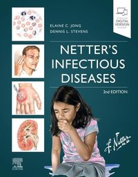 Produktbild: Netter's Infectious Diseases