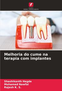Produktbild: Melhoria do cume na terapia com implantes