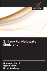 Produktbild: Zmiany torbielowate &iquest;ledziony