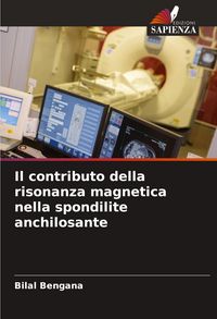 Produktbild: Il contributo della risonanza magnetica nella spondilite anchilosante
