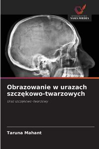 Produktbild: Obrazowanie w urazach szcz&iquest;kowo-twarzowych