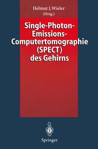 Produktbild: Single-Photon-Emissions-Computertomographie (SPECT) des Gehirns