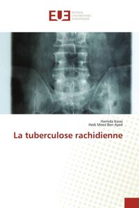 Produktbild: La tuberculose rachidienne