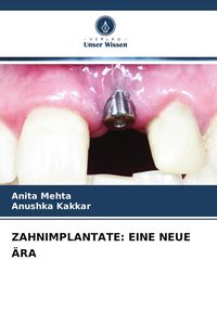 Produktbild: Zahnimplantate: eine Neue &Auml;ra