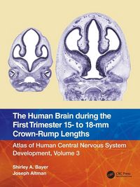 Produktbild: The Human Brain during the First Trimester 15- to 18-mm Crown-Rump Lengths