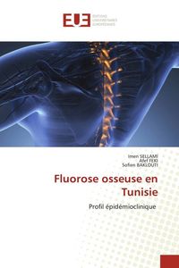 Produktbild: Fluorose osseuse en Tunisie