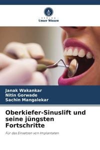 Produktbild: Oberkiefer-Sinuslift und seine j&uuml;ngsten Fortschritte