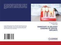 Produktbild: Immediate Vs Delayed Loading Of Dental Implants
