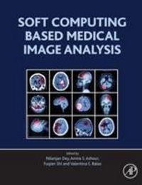 Produktbild: Dey, N: Soft Computing Based Medical Image Analysis