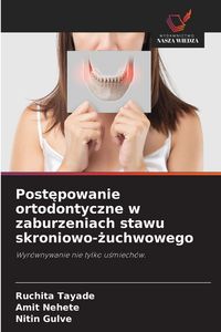 Produktbild: Post&iquest;powanie ortodontyczne w zaburzeniach stawu skroniowo-&iquest;uchwowego