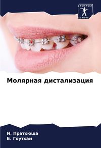 Produktbild: Molqrnaq distalizaciq