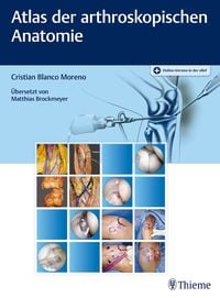 Produktbild: Atlas der arthroskopischen Anatomie