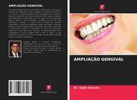 Produktbild: Amplia&ccedil;&atilde;o Gengival