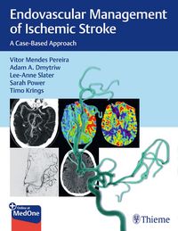 Produktbild: Endovascular Management of Ischemic Stroke