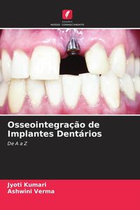 Produktbild: Osseointegra&ccedil;&atilde;o de Implantes Dent&aacute;rios