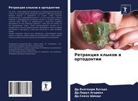 Produktbild: Retrakciq klykow w ortodontii