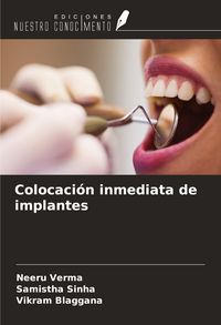 Produktbild: Colocaci&oacute;n inmediata de implantes