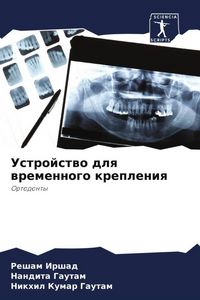 Produktbild: Ustrojstwo dlq wremennogo krepleniq