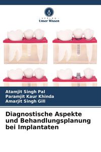 Produktbild: Diagnostische Aspekte und Behandlungsplanung bei Implantaten