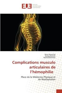 Produktbild: Complications musculo articulaires de l'h&eacute;mophilie