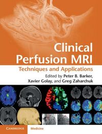 Produktbild: Clinical Perfusion MRI