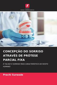 Produktbild: Concep&ccedil;&atilde;o Do Sorriso Atrav&eacute;s De Pr&oacute;tese Parcial Fixa