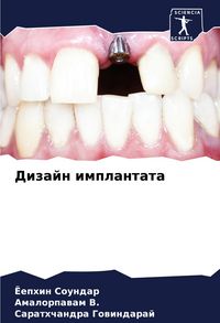 Produktbild: Dizajn implantata