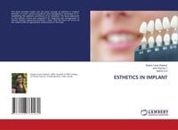 Produktbild: Esthetics in Implant