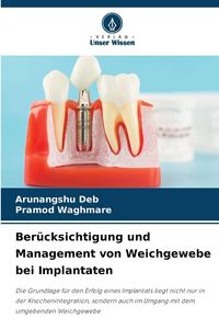 Produktbild: Ber&uuml;cksichtigung und Management von Weichgewebe bei Implantaten