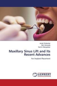 Produktbild: Maxillary Sinus Lift and Its Recent Advances