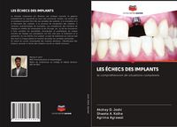 Produktbild: Les &Eacute;checs des Implants
