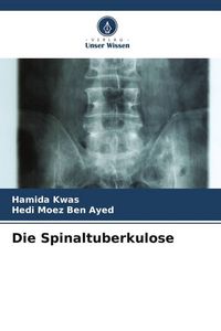 Produktbild: Die Spinaltuberkulose