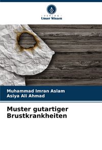 Produktbild: Muster gutartiger Brustkrankheiten