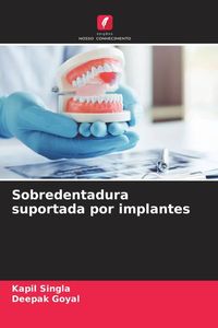 Produktbild: Sobredentadura suportada por implantes