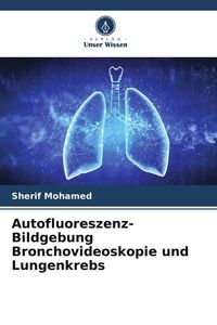 Produktbild: Autofluoreszenz-Bildgebung Bronchovideoskopie und Lungenkrebs
