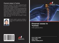 Produktbild: Fluorosi ossea in Tunisia