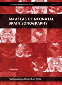 Bild vom Artikel An Atlas of Neonatal Brain Sonography vom Autor Paul Govaert