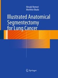 Produktbild: Illustrated Anatomical Segmentectomy for Lung Cancer