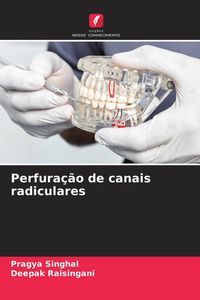 Produktbild: Perfura&ccedil;&atilde;o de canais radiculares