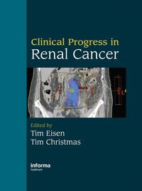Produktbild: Clinical Progress in Renal Cancer