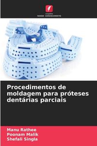 Produktbild: Procedimentos de moldagem para pr&oacute;teses dent&aacute;rias parciais