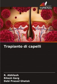 Produktbild: Trapianto di capelli